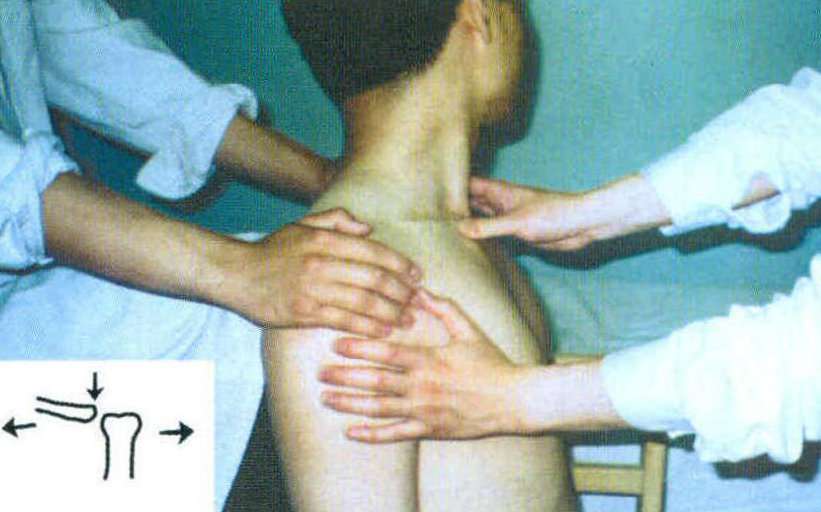 胸鎖關(guān)節(jié)脫位